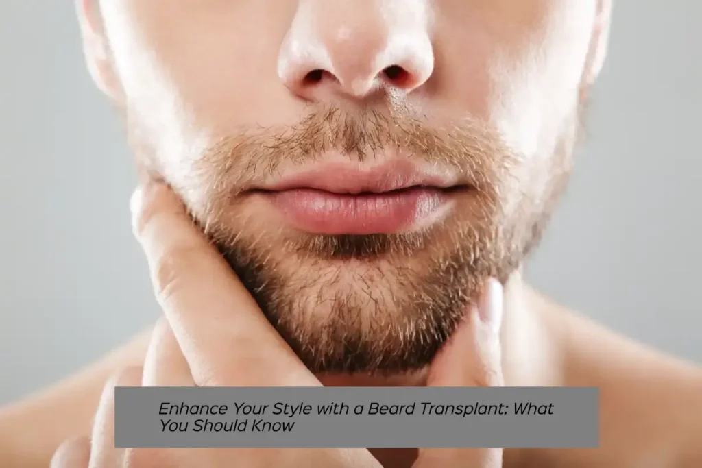 Enhance Your Style with a Beard Transplant: What You Should Know